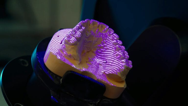 Numérisation 3D d'une empreinte dentaire au scanner, procédé Narval CC